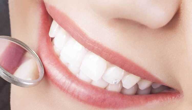Diş bakımı ve estetiğiyle ilgili 20 tüyo